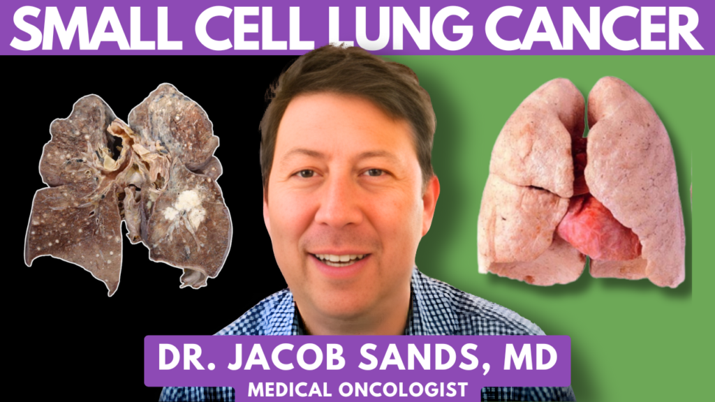 Small Cell Lung Cancer Treatment - Jacob Sands, MD