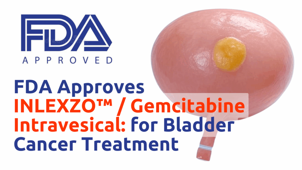 Guide on INLEXZO gemcitabine intravesical treatment for bladder cancer, focusing on NMIBC and bladder preservation.