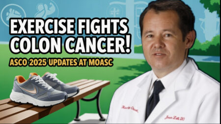 Thumbnail of a person jogging outdoors with a colon cancer ribbon, featuring text 'Exercise Boosts Colon Cancer Treatment' and 'ASCO & MOASC 2025' updates, symbolizing new treatment advancements.