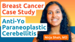 Breast Cancer Case Study featuring Dr. Nirja Shah, MD, on anti-Yo paraneoplastic cerebellitis, bilateral breast cancer diagnosis, UC San Diego Health.